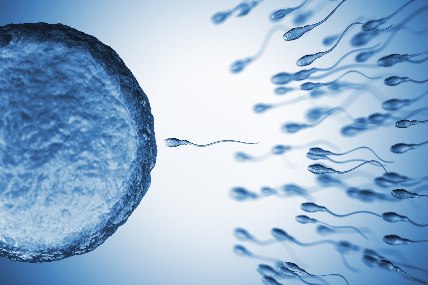 IUI