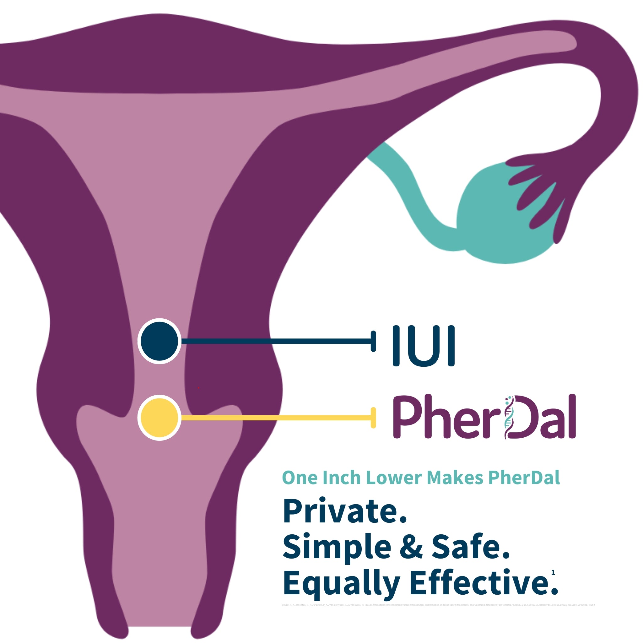 at home insemination syringe success with home IUI Kit reviewers say pherdal is the best at home IUI kit for male factor infertility treatment